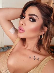 631112662: Travesti en Madrid